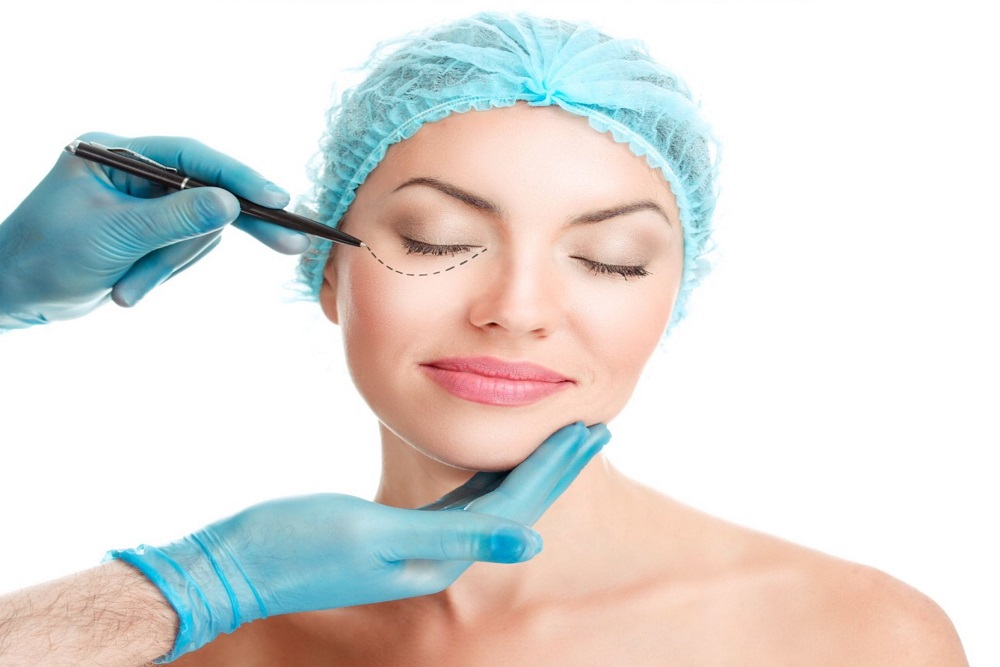 BLEPHAROPLASTY (EYELID AESTHETICS)